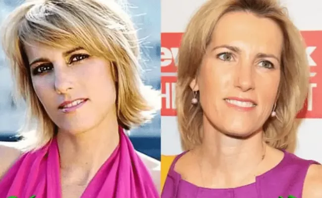 Laura Ingraham Lips: Before and After Photo.