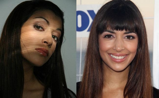 Hannah Simone Plastic Surgery Before And After (source: Murraculous)