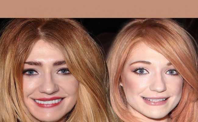 Nicola Roberts Plastic Surgery before and after pictures. (Source: Dailymail)