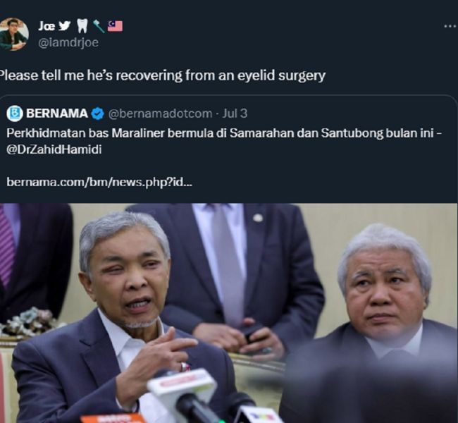A person on Twitter talking about Zahid Hamidi’s eye surgery. (Source: Twitter)