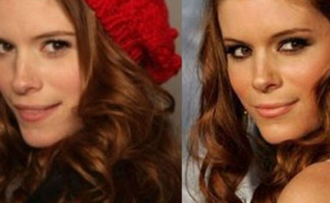 Before and after pictures of Kate Mara following a nose job. (Source: lovelysurgery.com)